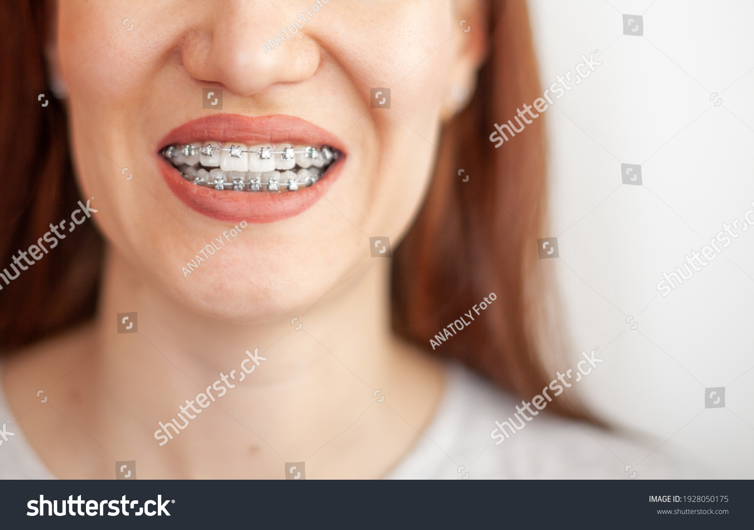 Orthodontics