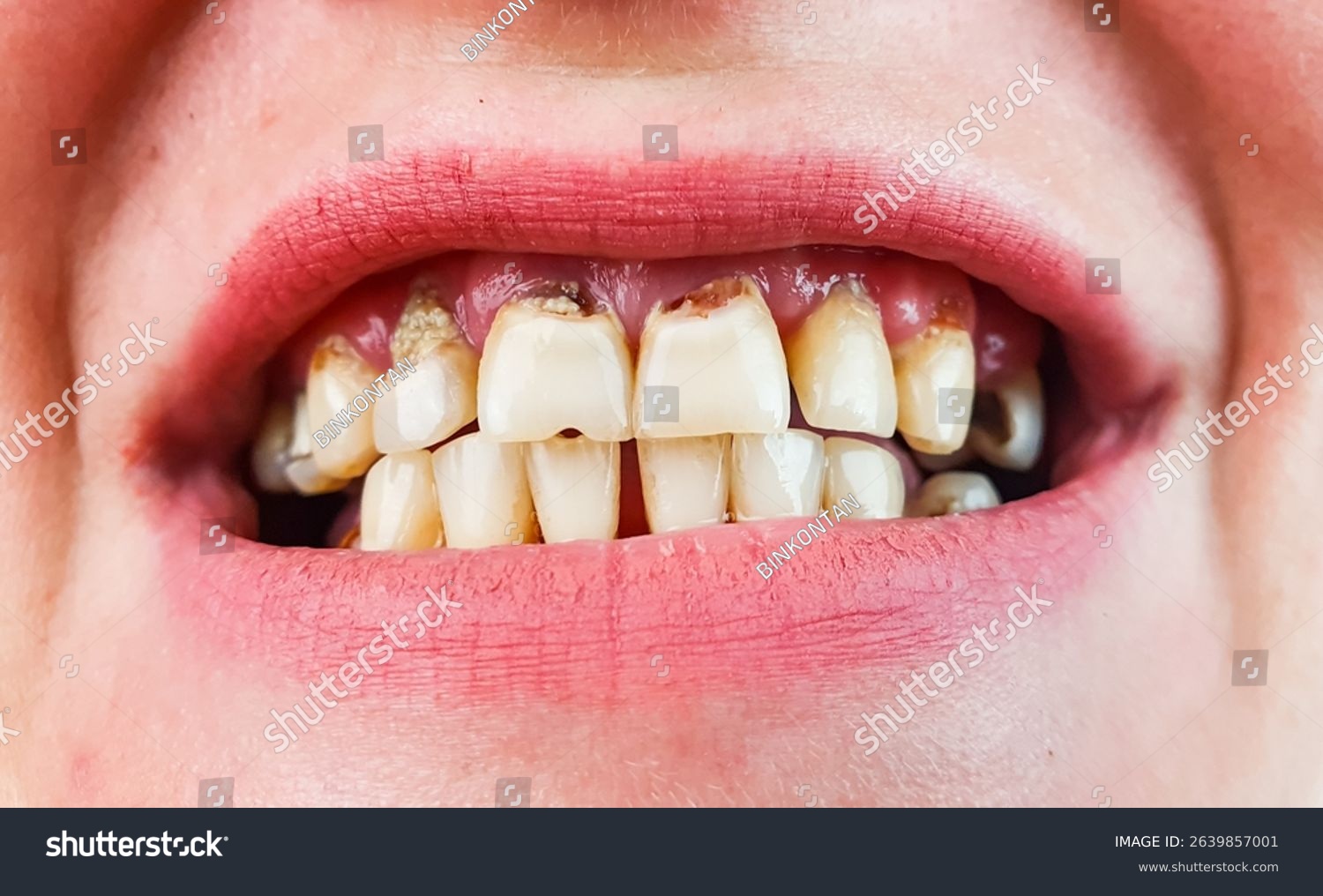 Periodontics